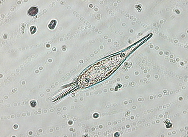 Dictyocha speculum